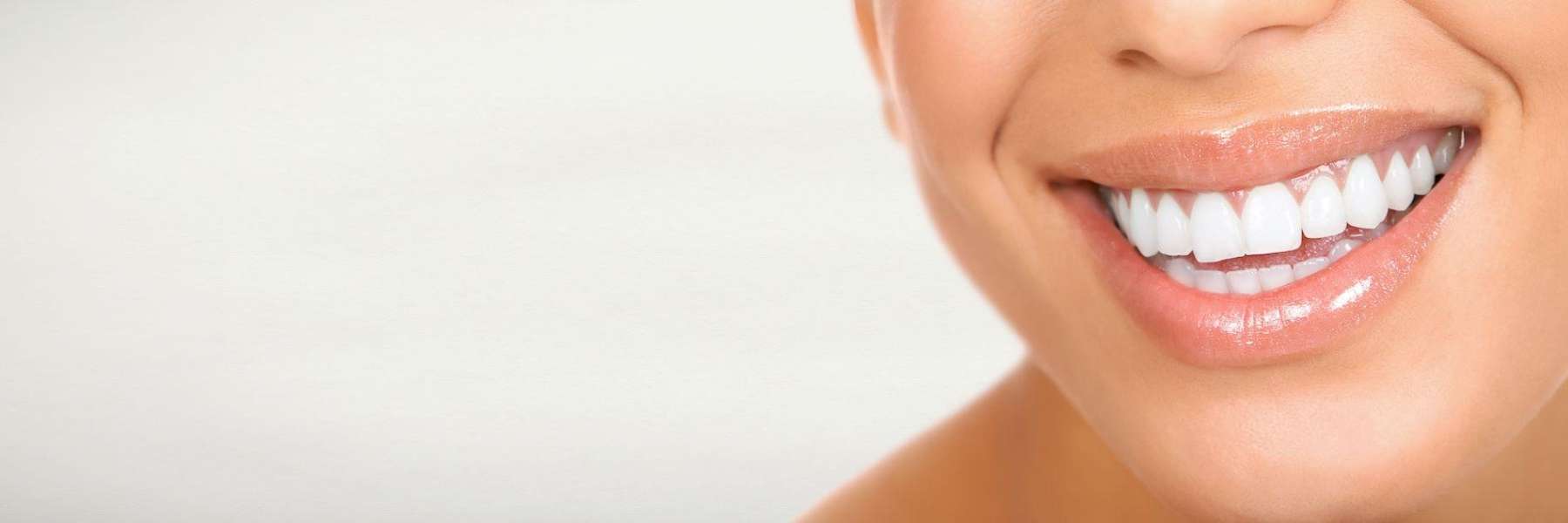 Lady smiling after getting dental implants in Neutral Bay, NSW