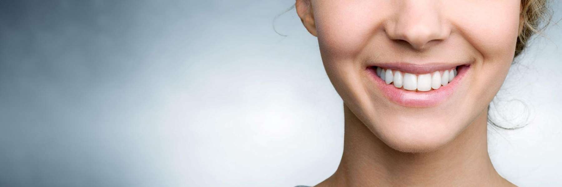 A picture of a lady smiling after a teeth whitening service in Neutral Bay, NSW.