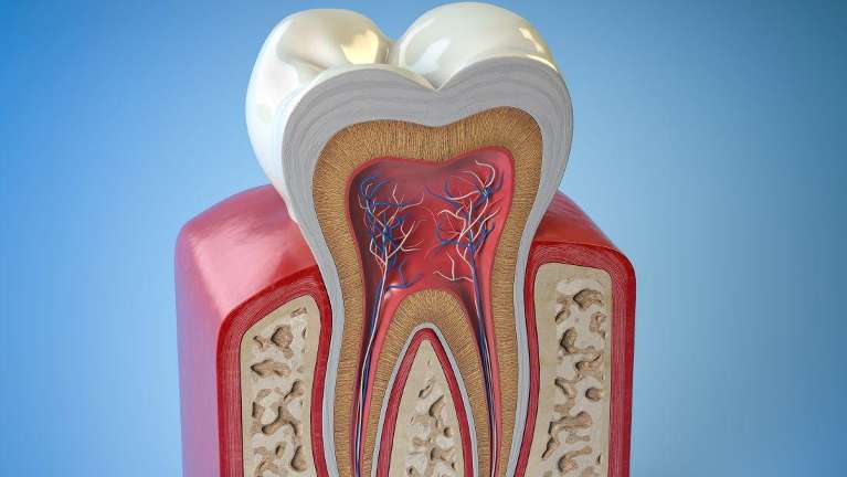 An illustration of a root canal in Neutral Bay, NSW