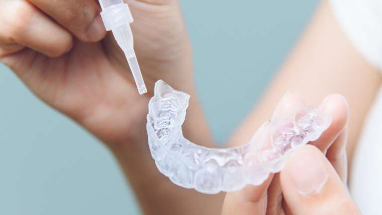 Hand holding clear aligners in Neutral Bay, NSW