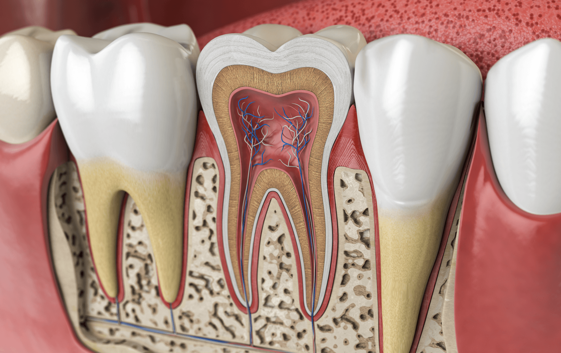 Model of root canal in Neutral Bay, NSW