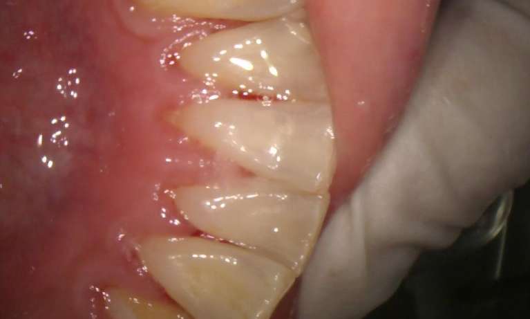 toot cleaning in neutral bay