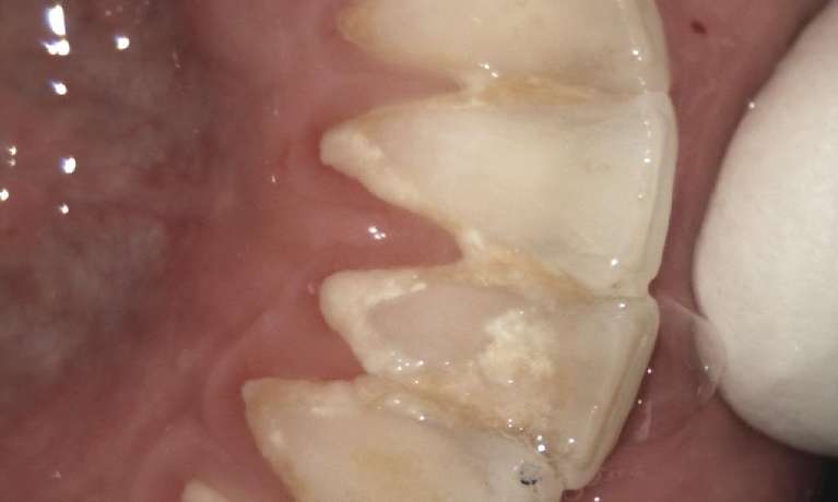 toot cleaning in neutral bay